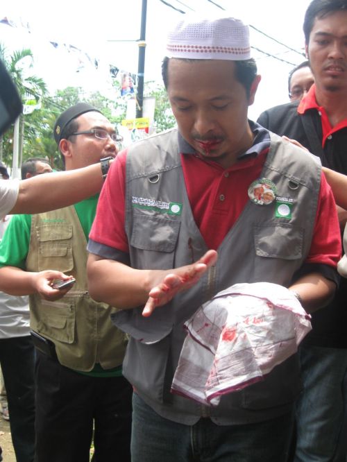 Salah seorang penyokong PAS tercedera dan berdarah terkena balingan batu oleh penyokong UMNO BN